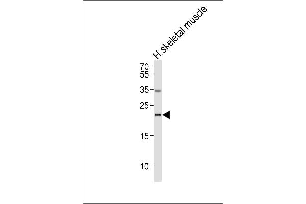 IFNW1 antibody