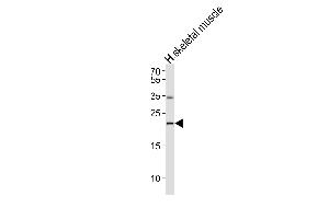 Western blot analysis of lysate from human skeletal muscle tissue lysate,using IFNW1 Antibody was diluted at 1:1000. (IFNW1 antibody)