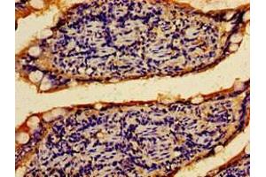 Immunohistochemistry of paraffin-embedded human small intestine tissue using ABIN7167505 at dilution of 1:100 (PTPRF antibody  (AA 688-970))