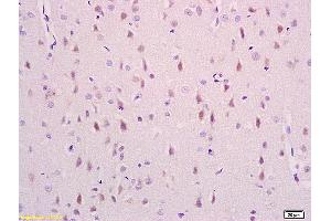 Formalin-fixed and paraffin embedded rat brain labeled with Anti phospho-NDEL1(Ser231) Polyclonal Antibody,Unconjugated (ABIN710801) at 1:200 followed by conjugation to the secondary antibody and DAB staining.