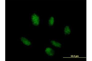 Immunofluorescence of purified MaxPab antibody to TINF2 on HeLa cell. (TINF2 antibody  (AA 1-451))