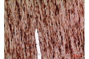 Immunohistochemistry (IHC) analysis of paraffin-embedded Human Colon, antibody was diluted at 1:100. (AAT (Internal Region) antibody)