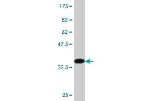 Western Blot detection against Immunogen (36. (Neuroligin 1 antibody  (AA 578-677))