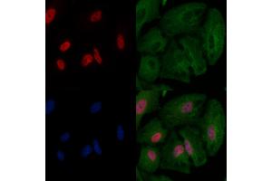 ABIN6263158 and ABIN6266586 staining  cells by IF/ICC. (MCM2 antibody  (N-Term))