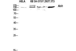 Western Blot (WB) analysis of HeLa KB SH-SY5Y 293T 3T3 lysis using Abl1 antibody.
