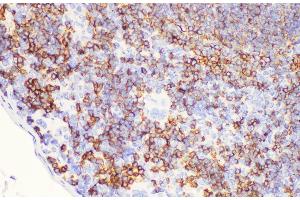 Immunohistochemistry of paraffin-embedded Mouse spleen using CD20 Polycloanl Antibody at dilution of 1:100 (CD20 antibody)