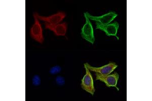 ABIN6264452 and ABIN6276642 staining Hela cells by IF/ICC.