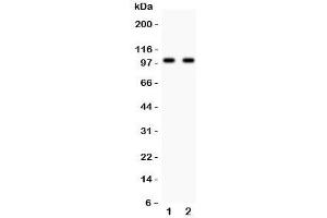 Western blot testing of Glutamate receptor 3 antibody and Lane 1:  rat brain;  2: mouse brain lysate. (Glutamate Receptor 3 antibody  (AA 29-360))