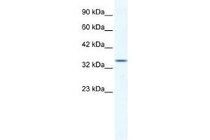 ZFP589 antibody (20R-1179) used at 0. (ZFP589 (Middle Region) antibody)