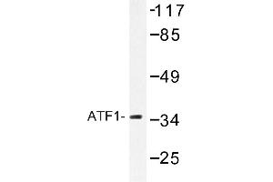 Image no. 1 for anti-Activating Transcription Factor 1 (AFT1) antibody (ABIN272179) (AFT1 antibody)