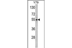 Western blot analysis of Fascin Antibody in Y79 cell line lysates (35ug/lane) (Fascin antibody  (AA 322-350))