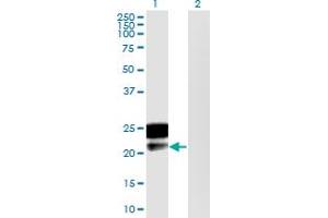 Western Blot analysis of DMRTB1 expression in transfected 293T cell line by DMRTB1 monoclonal antibody (M02), clone 5E7. (DMRTB1 antibody  (AA 1-189))
