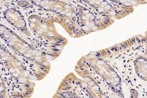 Immunohistochemistry analysis of paraffin-embedded rat rectum using,NME7 (ABIN7074918) at dilution of 1: 4200 (NME7 antibody)