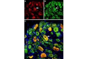 Multiplex staining of ASIC1 and ASIC3 in rat DRGImmunohistochemical staining of perfusion-fixed frozen rat dorsal root ganglia (DRG) sections using Guinea pig Anti-ASIC1 Antibody (ABIN7042914, ABIN7045410 and ABIN7045411), (1:400) and rabbit Anti-ASIC3 Antibody (ABIN7042917, ABIN7045243 and ABIN7045244), (1:400). (Amiloride-Sensitive Cation Channel 3 (ACCN3) Peptide)