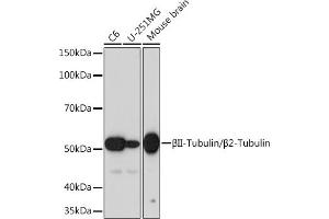 Western blot analysis of extracts of various cell lines, using βII-Tubulin/β2-Tubulin Rabbit mAb (ABIN1680983, ABIN3019216, ABIN3019217 and ABIN7101733) at 1:1000 dilution. (TUBB2A/TUBB2B antibody)