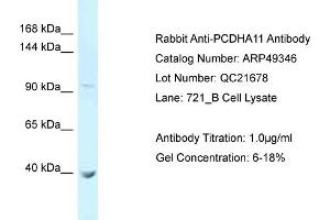 WB Suggested Anti-PCDHA11 Antibody   Titration: 1. (PCDHA11 antibody  (N-Term))