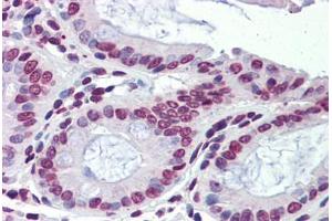 Immunohistochemistry (Paraffin-embedded Sections) (IHC (p)) image for anti-Nuclear Receptor Subfamily 1, Group H, Member 3 (NR1H3) (C-Term) antibody (ABIN462212)
