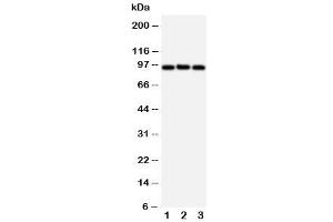 Western blot testing of ABCB6 antibody and Lane 1:  HeLa (ABCB6 antibody  (C-Term))