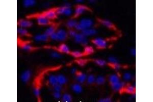 Immunofluorescence analysis of Human breast tissue using CK-17 Monoclonal Antibody at dilution of 1:200. (KRT17 antibody)