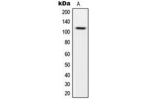 Western blot analysis of CARD14 expression in HeLa (A) whole cell lysates. (CARD14 antibody  (Center))