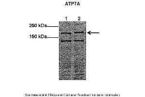 Western Blotting (WB) image for anti-ATPase, Cu++ Transporting, alpha Polypeptide (ATP7A) (Middle Region) antibody (ABIN2778126)