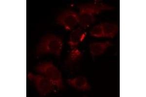ABIN6275431 staining A549 by IF/ICC. (PDHA1 antibody  (C-Term))