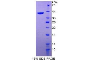 SDS-PAGE (SDS) image for Chemokine (C-C Motif) Ligand 22 (CCL22) (AA 25-93) protein (His tag,GST tag) (ABIN1877719) (CCL22 Protein (AA 25-93) (His tag,GST tag))