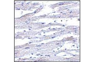 Immunohistochemistry of RIG-1 in human heart tissue with this product at 5 μg/ml. (DDX58 antibody)