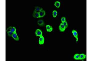 Immunofluorescent analysis of A431 cells using ABIN7161614 at dilution of 1:100 and Alexa Fluor 488-congugated AffiniPure Goat Anti-Rabbit IgG(H+L) (NINJ2 antibody  (AA 17-81))