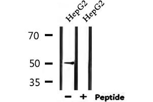 Western blot analysis of extracts from HepG2, using HTR3D Antibody. (HTR3D antibody)