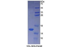 SDS-PAGE analysis of Human CF6 Protein.