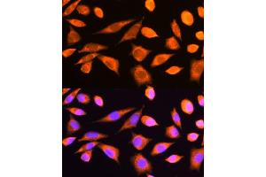 Immunofluorescence analysis of L929 cells using RPS20 antibody (ABIN6129112, ABIN6147211, ABIN6147212 and ABIN6214592) at dilution of 1:100. (RPS20 antibody  (AA 1-119))