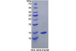 SDS-PAGE analysis of Human IL10Ra Protein.