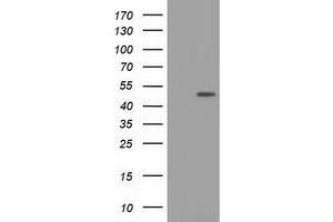 HEK293T cells were transfected with the pCMV6-ENTRY control (Left lane) or pCMV6-ENTRY XPNPEP1 (Right lane) cDNA for 48 hrs and lysed. (XPNPEP1 antibody)