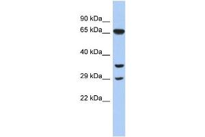 WB Suggested Anti-RYBP Antibody Titration:  0. (RYBP antibody  (N-Term))