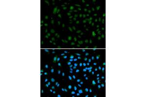 Immunofluorescence analysis of A549 cells using WHSC1L1 antibody (ABIN5973250). (WHSC1L1 antibody)
