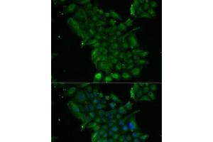 Immunofluorescence analysis of MCF7 cells using TCN1 Polyclonal Antibody (TCN1 antibody)