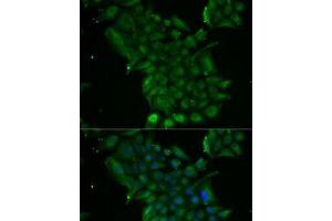 Immunofluorescence analysis of MCF7 cells using TCN1 Polyclonal Antibody