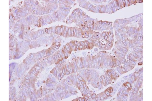 CSNK1A1L antibody