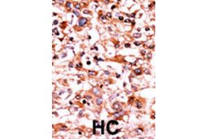Immunohistochemistry (IHC) image for anti-Cyclin-Dependent Kinase 1 (CDK1) (pSer39) antibody (ABIN3001750)