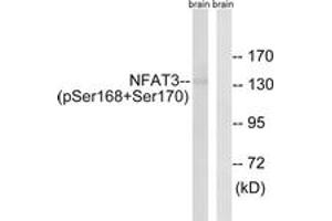 Western Blotting (WB) image for anti-Nuclear Factor of Activated T-Cells, Cytoplasmic, Calcineurin-Dependent 4 (NFATC4) (AA 136-185), (pSer168) antibody (ABIN1532159) (NFATC4 antibody  (pSer168))