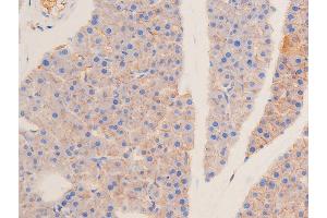Immunohistochemistry (IHC) image for anti-Tumor Protein P53 (TP53) (pSer15) antibody (ABIN6256151)