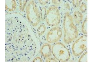 Immunohistochemistry of paraffin-embedded human kidney tissue using ABIN7167058 at dilution of 1:100 (RSAD2 antibody  (AA 42-361))