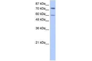 IGF2BP1 antibody used at 0. (IGF2BP1 antibody  (N-Term))