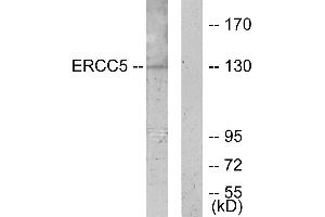 Western blot analysis of extracts from K562 cells, using ERCC5 antibody.