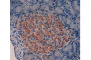 IHC-P analysis of pancreas tissue, with DAB staining. (IL-17 antibody  (AA 20-155))