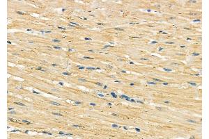 ABIN6262032 and ABIN6278985 at 1/100 staining Rat heart tissue by IHC-P. (GOLT1B antibody  (C-Term))