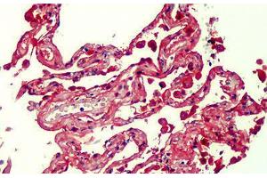 Human Lung: Formalin-Fixed, Paraffin-Embedded (FFPE) (RAGE antibody  (Cy3))
