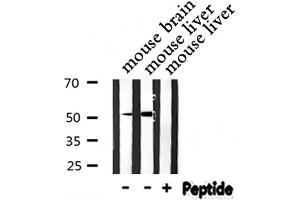 Western blot analysis of CXCR7 expression in various lysates (CXCR7 antibody  (Internal Region))