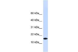 PHLDA3 antibody used at 1 ug/ml to detect target protein. (PHLDA3 antibody  (N-Term))